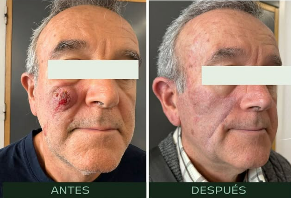 cirugia-facial-reconstructiva