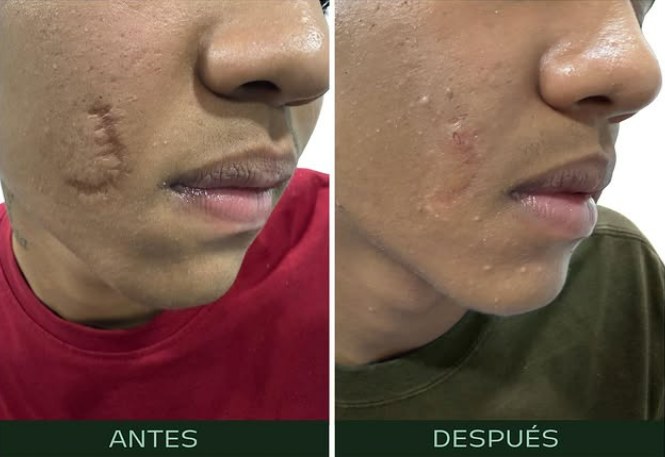 cirugia-reparadora-reconstructiva-cicatrices-cara