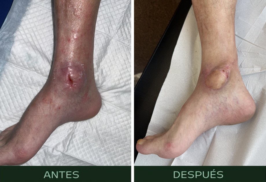 cirugia-reparadora-reconstructiva-tobillo