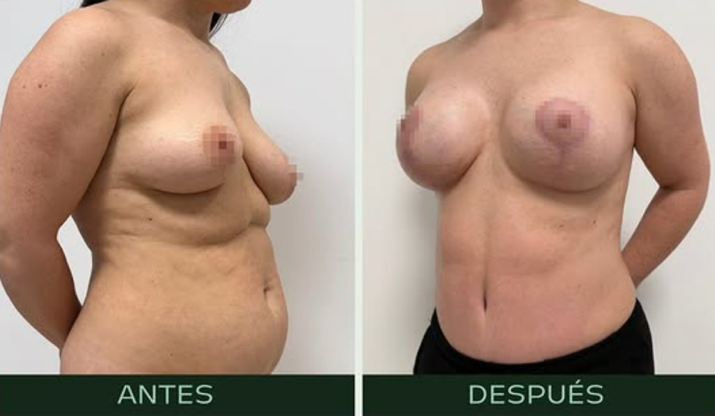drmartinezalfaro-cirugia-combinada-c2